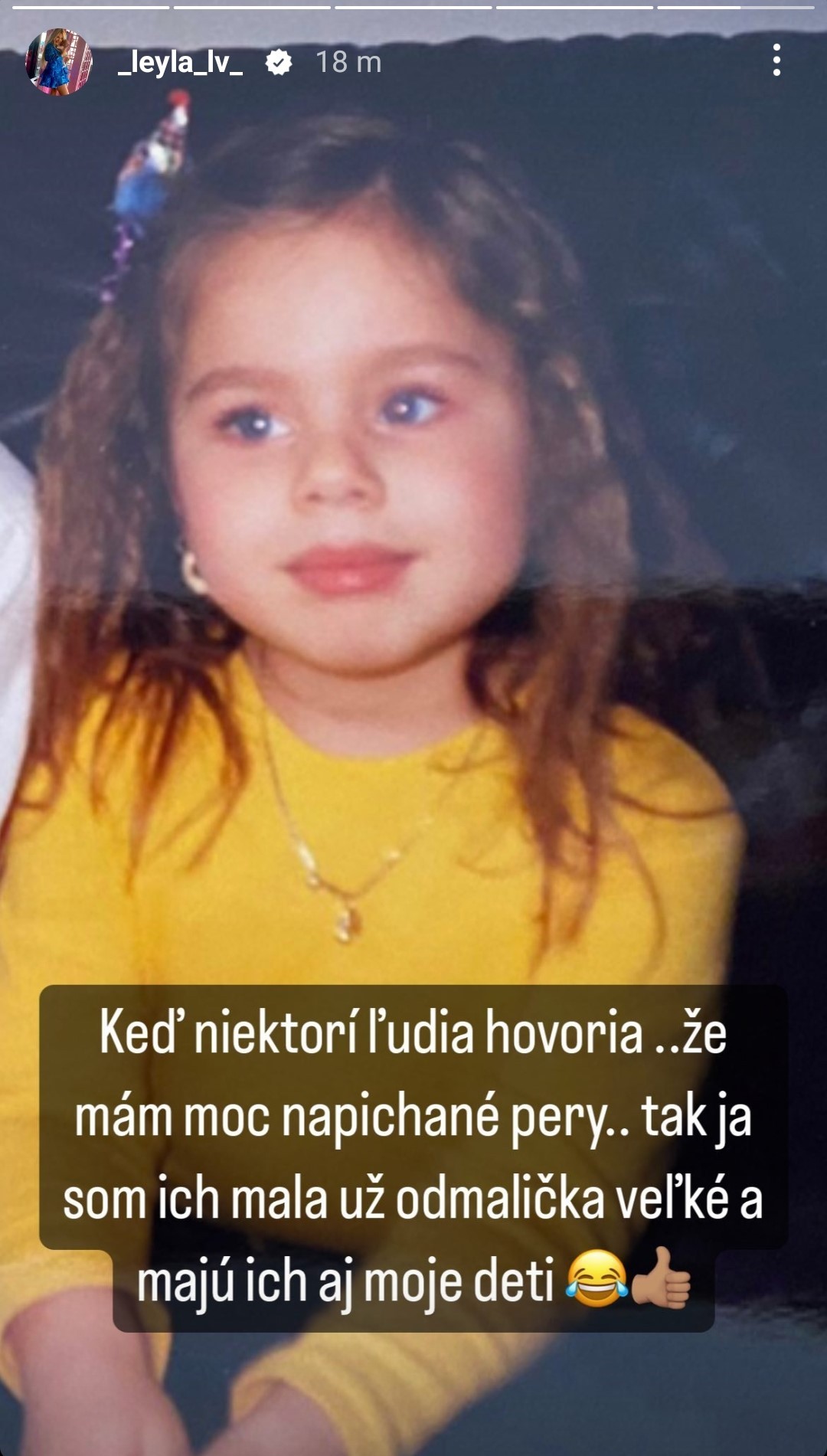 Laura Vizváryová mala už ako dieťa prirodzene veľké pery.