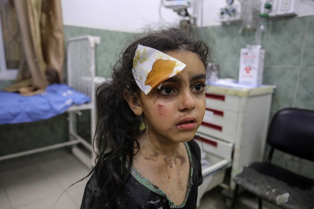 W szpitalach w Strefie Gazy zaczyna brakować jedzenia i środków medycznych