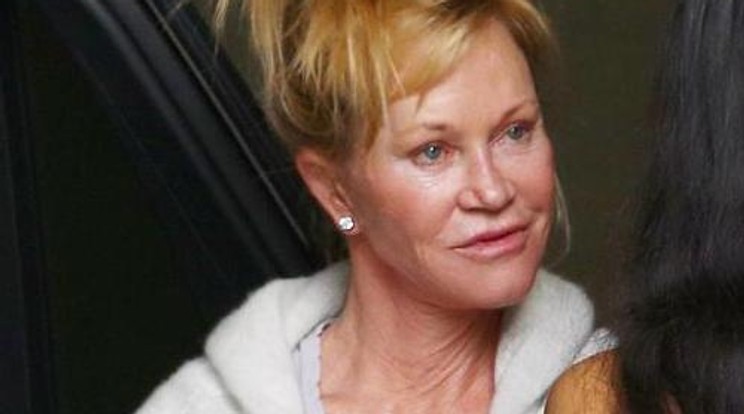 Erre a fotóra nem lesz büszke Melanie Griffith