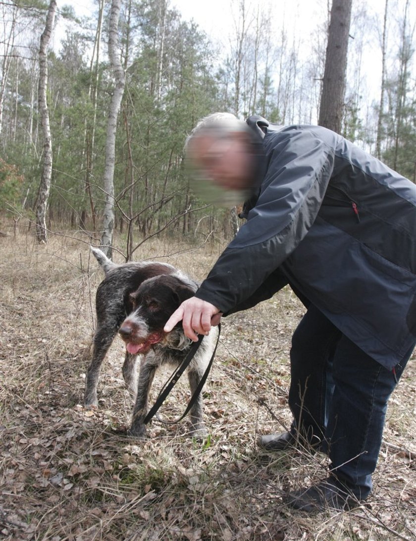 To on znalazł w lesie odcięte dłonie!