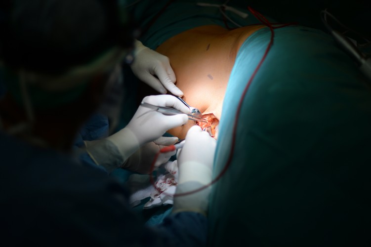 Przeszczep krzyżowy nerek. Pierwszy taki w Polsce