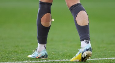 Why do so many footballers cut holes in their socks?
