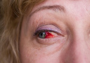 Ilustracija: Krvave oči