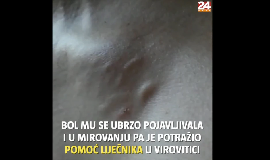 Paraziti koji mu prave problem četiri godine