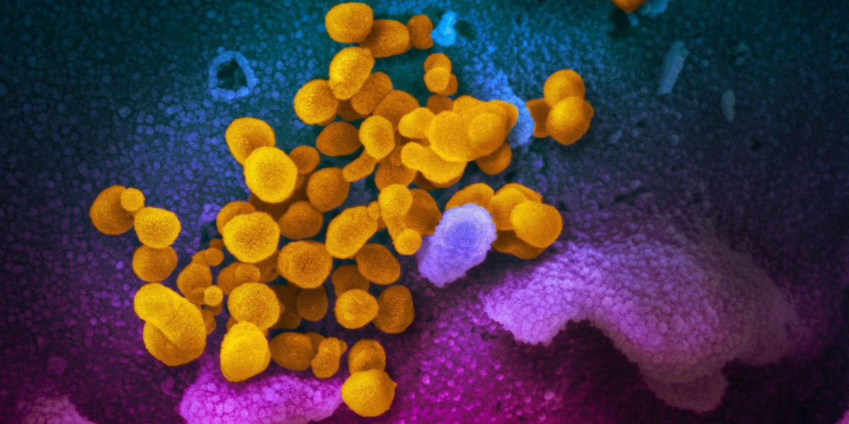 SARS-CoV-2 (żółty) wyizolowany od pacjenta, widoczny w mikroskopie elektronowym, w hodowli komórek (fioletowo-niebieskie) w laboratorium.