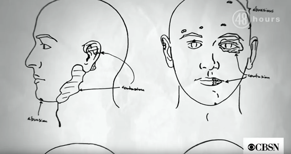 Kejline povrede u skladu sa napadom a ne "grubim seksom"