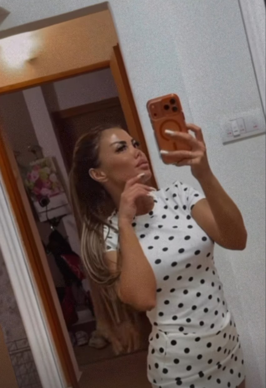 Starleta rodila sina 19 godina starijem, 8 puta operisala nos i pokazala lice