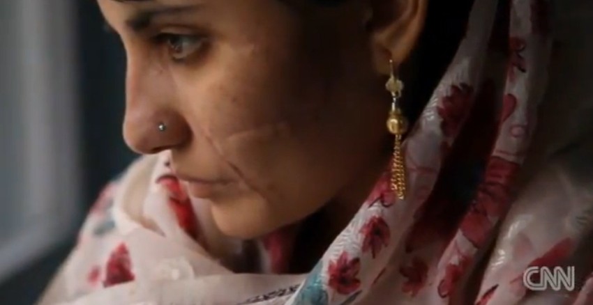 Lekari su učinili pravi podvig i spasli joj život nakon 15 udaraca sekirom, ali lice joj je ostalo unakaženo