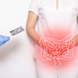 A Crohn-betegség oka, tünetei és kezelési lehetőségei