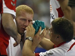 Dramat świetnego piłkarza. Straci oko?