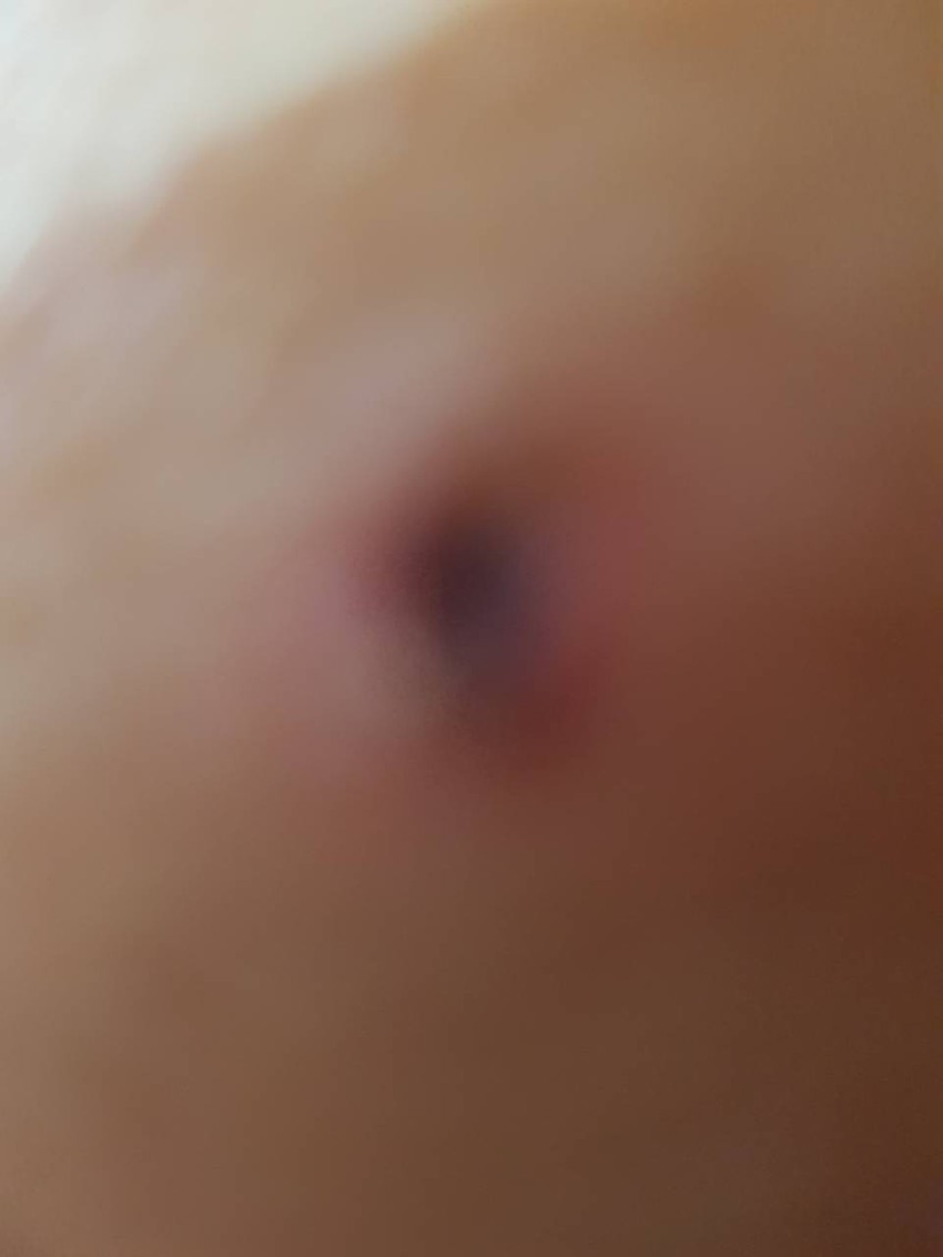 Negotin doktor porodilja ujed foto RAS.jpg4 foto RAS.jpg4