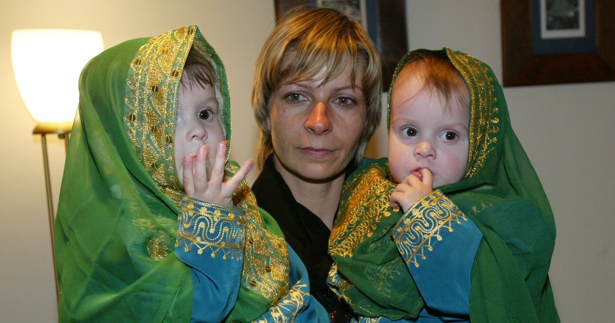 Polska pamięta ich historię. Tak dziś wyglądają bliźniaczki syjamskie z Janikowa 20 lat po operacji