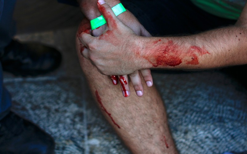 Pomoc osobie ranionej nożem w czasie parady gejów w Jerozolimie