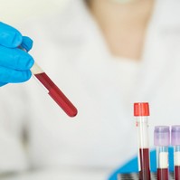 Mit lehet kimutatni egy vérvizsgálatból? Így értelmezze a leleten a jelöléseket
