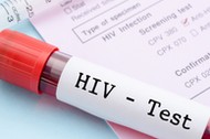 Bardziej boimy się koronawirusa niż wirusa HIV