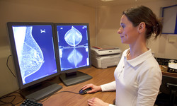 Zaawansowany rak piersi – co warto wiedzieć?