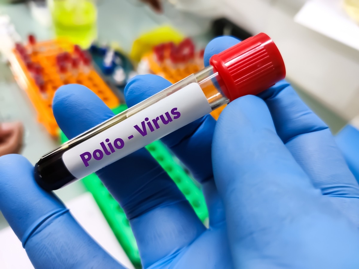 W Polsce szczepienia przeciwko poliomyelitis są obowiązkowe