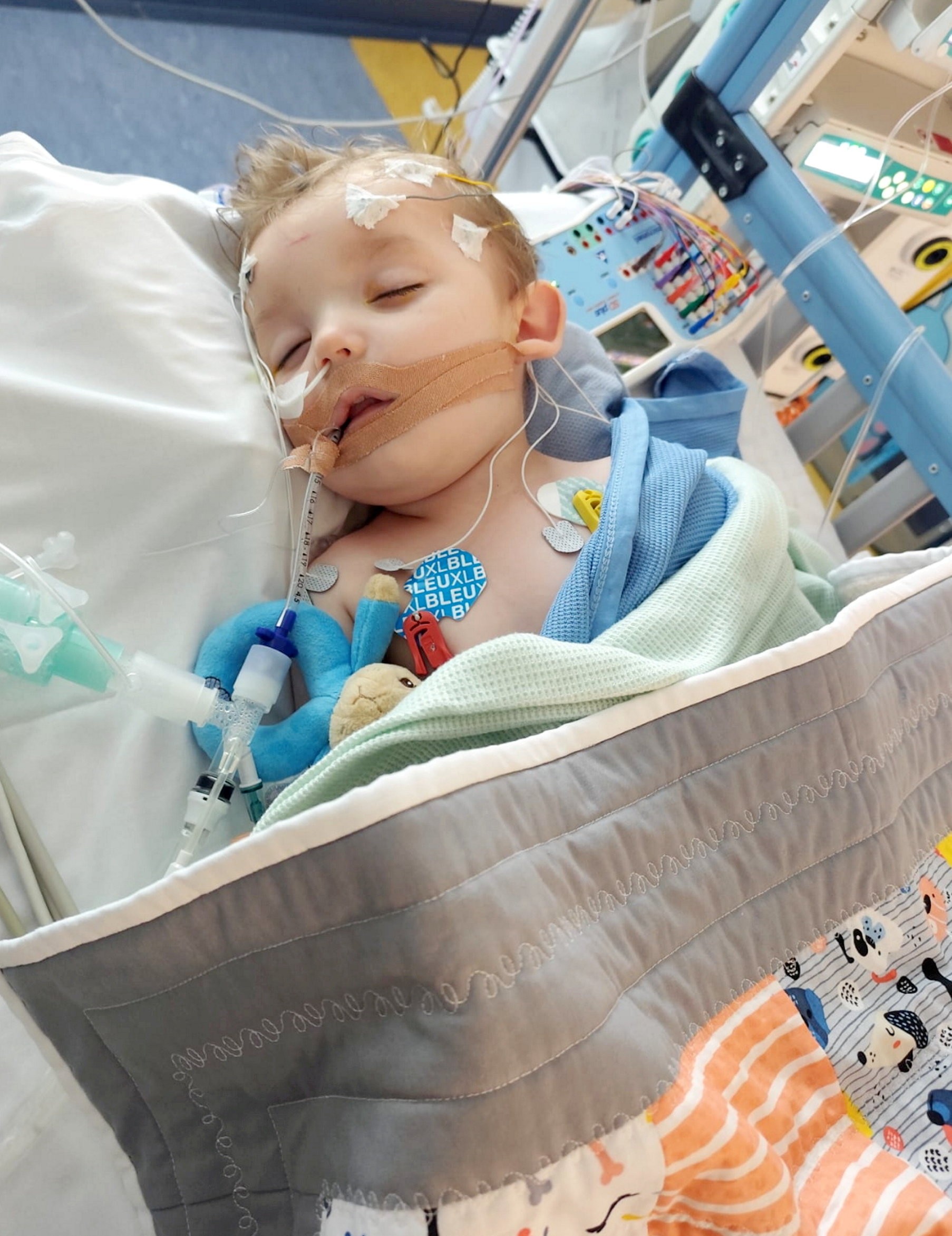 Na Oli-Jayovu chorobu v súčasnosti neexistuje liek.