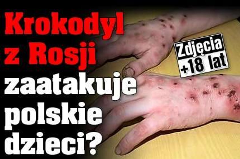 Krokodyl z Rosji zaatakuje polskie dzieci? Foto od 18 lat