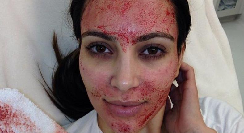 Did you know you can use your own blood for a facial?