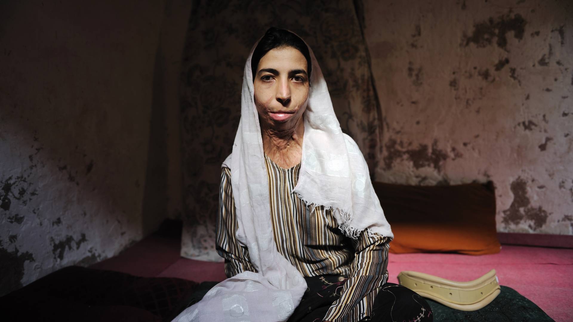 Афганские женщины изуродованные