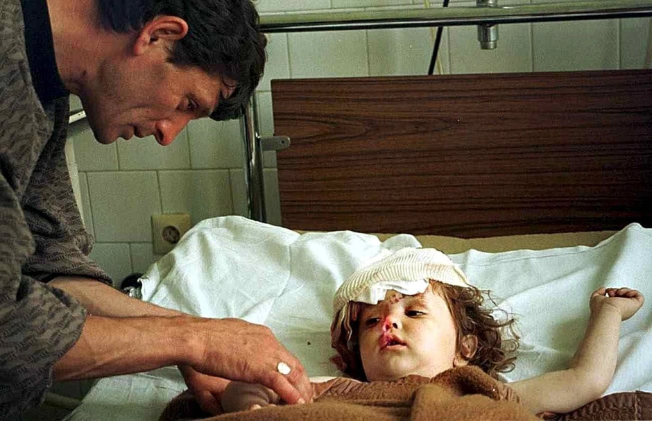 Među povređenima i poginulima tokom bombardovanja bilo je i mališana