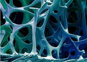 csontritkulas-280x200-d00000864ddb4584f4433