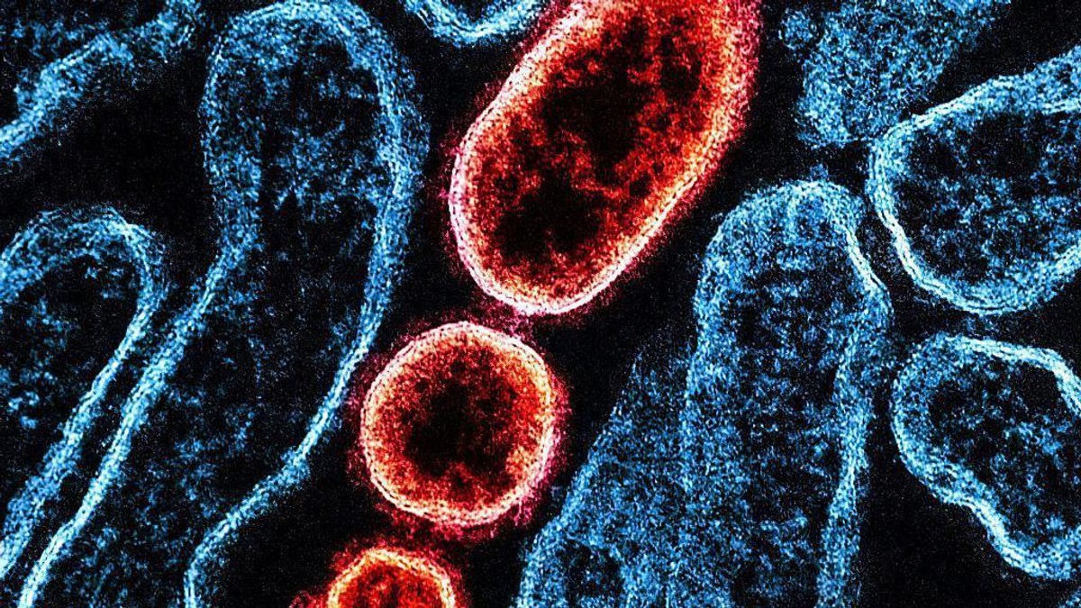 Transmisiona elektronska mikrografija zrelih ekstracelularnih vezikula nipa virusa (crveno) blizu periferije zaražene Vero ćelije (plavo) | Foto: Universal Images Group/Getty Images