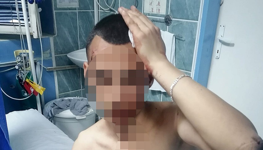 Pretučen mladić u Smederevu