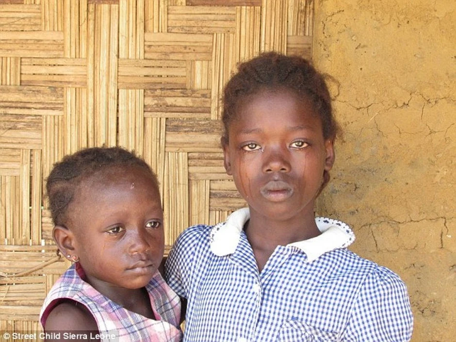 Džejn sa mlađom sestrom Fatamatom. Preživljavaju na malo pirinča (FOTO: Street Child Sierra Leone)
