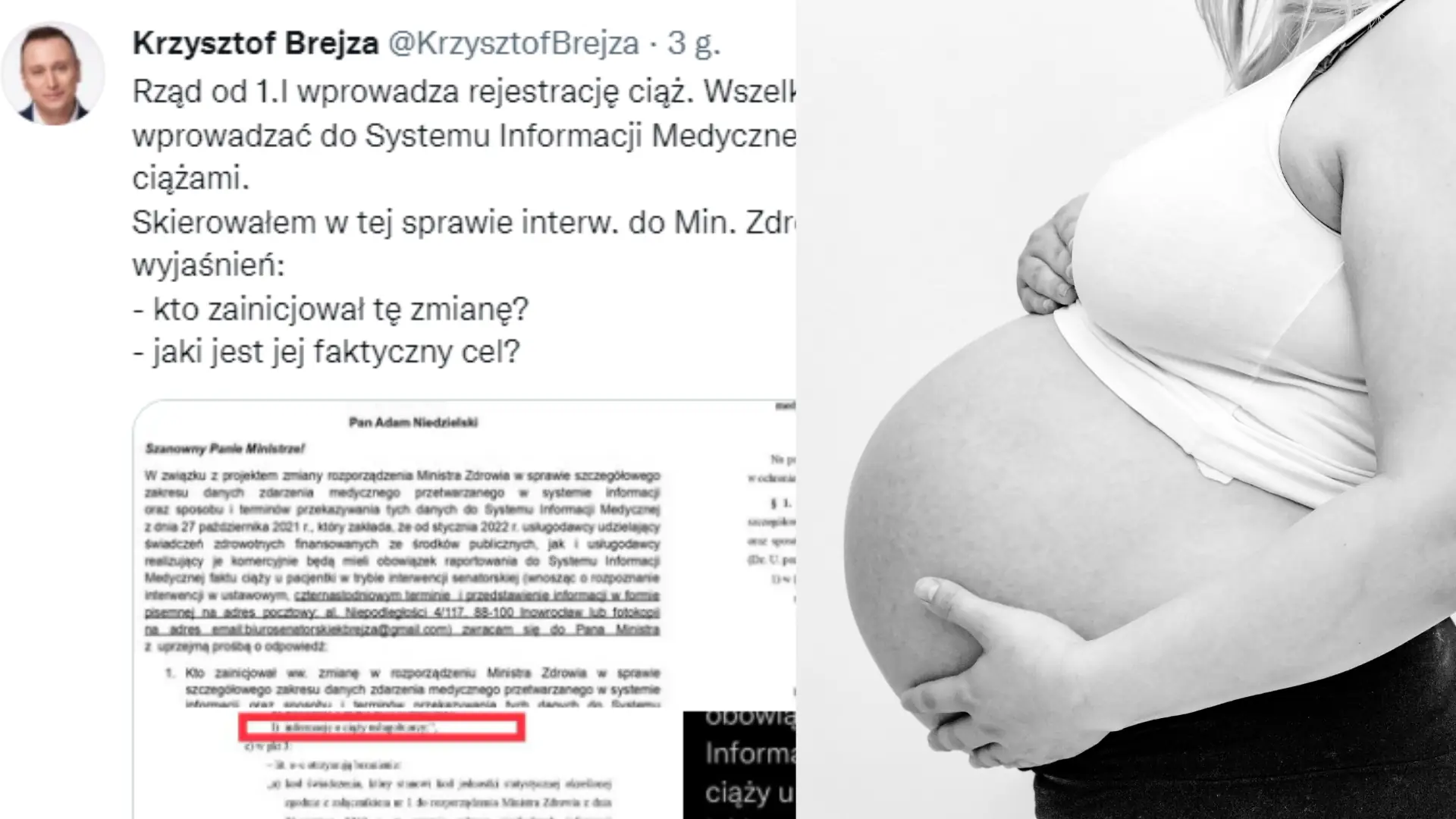 "Narodowy Rejestr Ciąż". Zapowiadają się zmiany w Systemie Informacji Medycznej