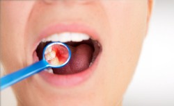 Fluoryzacja wody nie szkodzi środowisku a skutecznie zapobiega próchnicy [BADANIE]