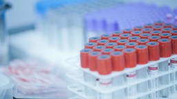 badania krwi pracownika – kiedy są obowiązkowe i od czego zależy ich z