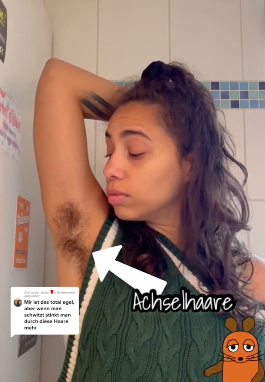 Influencerka sa rozhodla viac neskrývať svoje ochlpenie.
