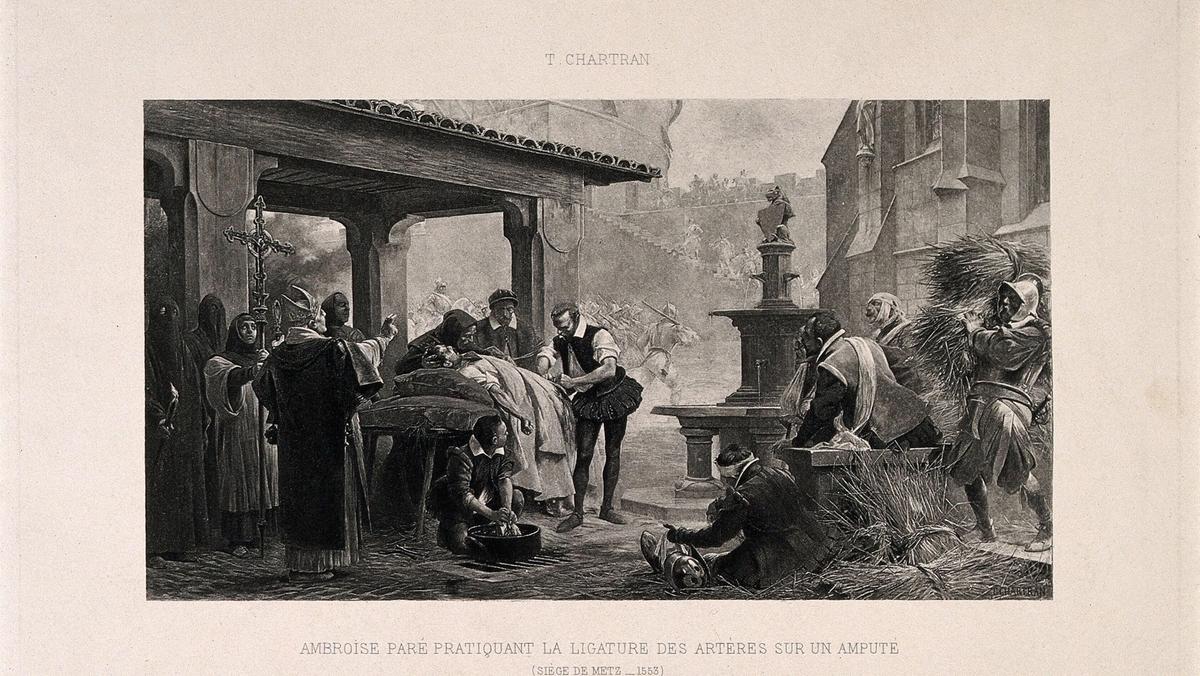 Ambroise Paré podwiązuje tętnicę po amputacji nogi żołnierzowi podczas oblężenia Metzu w 1553 r. Fotograwiura według T. Chartrana, 1889 r.