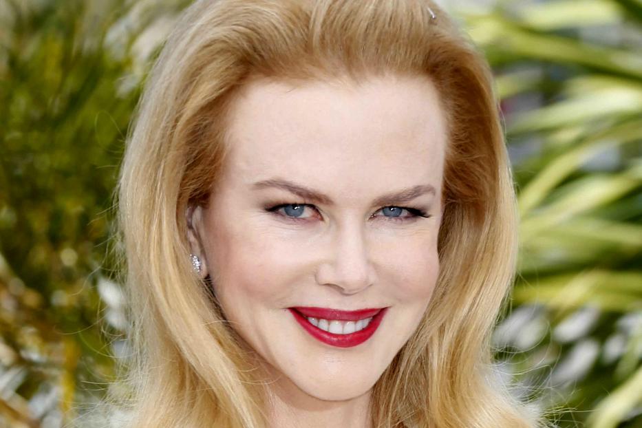 Úristen, mi történt két év alatt Nicole Kidman arcával?