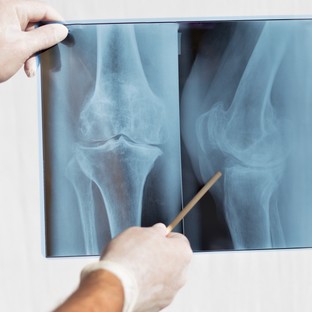 Ultramodern röntgenkészülék a pécsi belgyógyászati klinikán