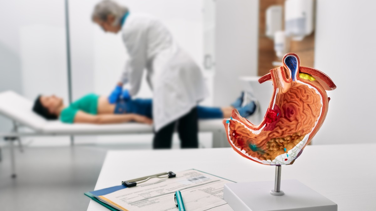 Čir na želucu je otvorena rana na sluzokoži želuca