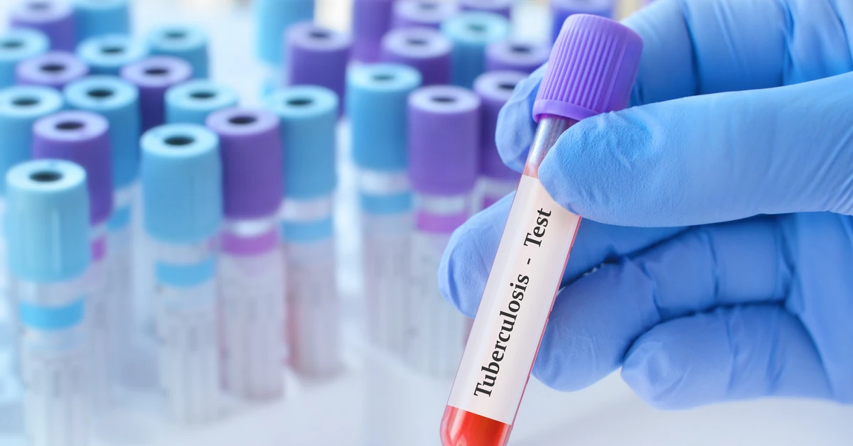 Gruźlica w szkole. Nauczycielka mogła zarazić kilkuset uczniów