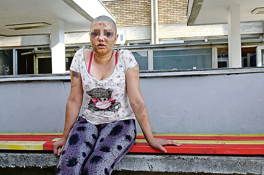 Nesrećna žena nasilje trpela i ranije