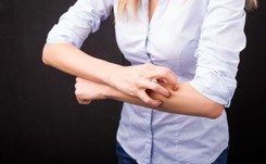 Łuszczyca dotyczy nie tylko skóry, ale całego organizmu