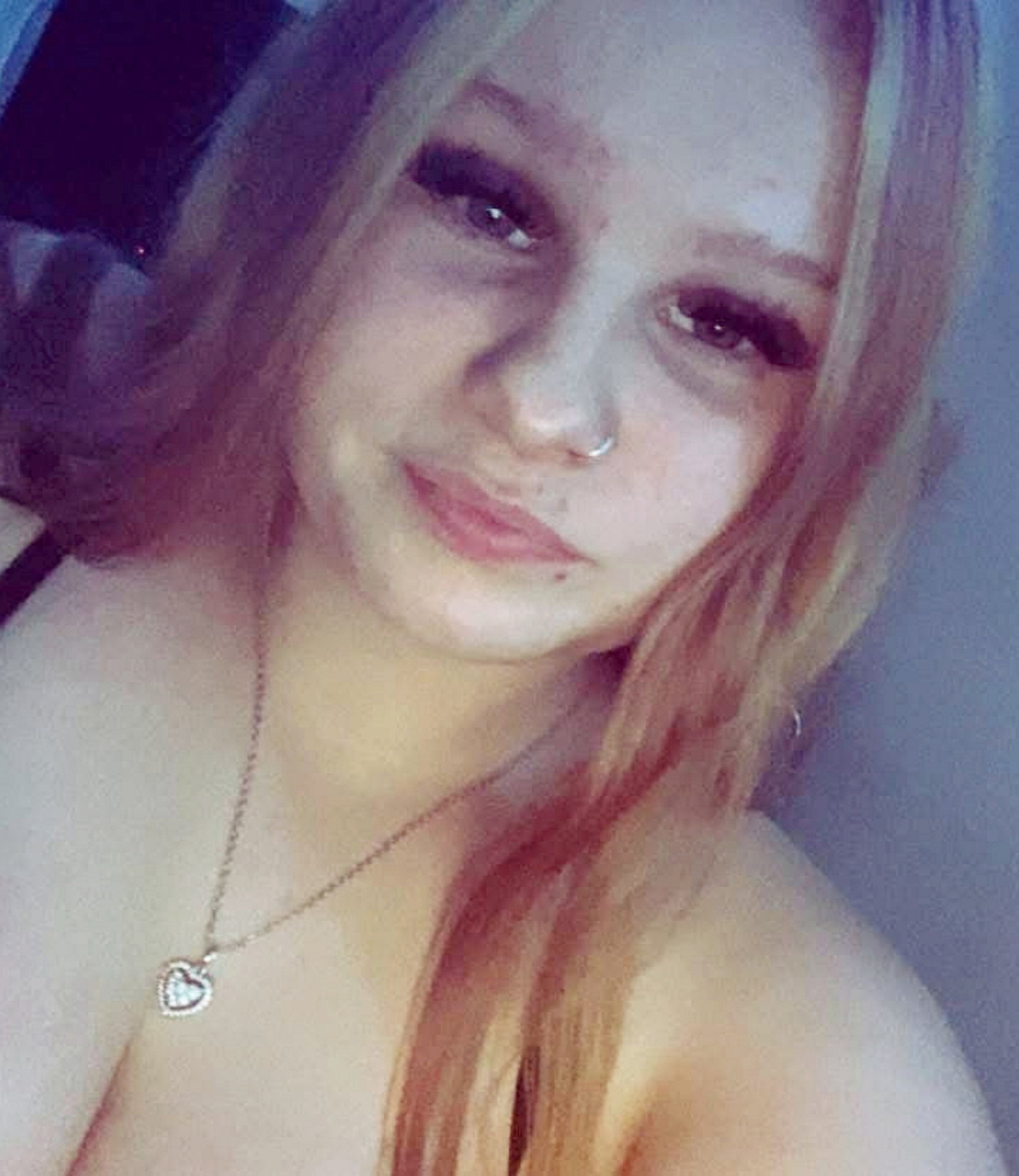 Shakira Gorman bojuje o život po tom, čo utrpela mimoriadne zriedkavú mozgovú príhodu.