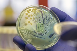 Microbiologist examining a multi-drug resistant coliform (Klebsiella pneumoniae) bacteria on CLED ag