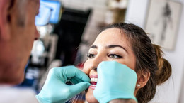 Implanty zębów - techniki i zalety implantologii. Ile kosztują implanty zębów?