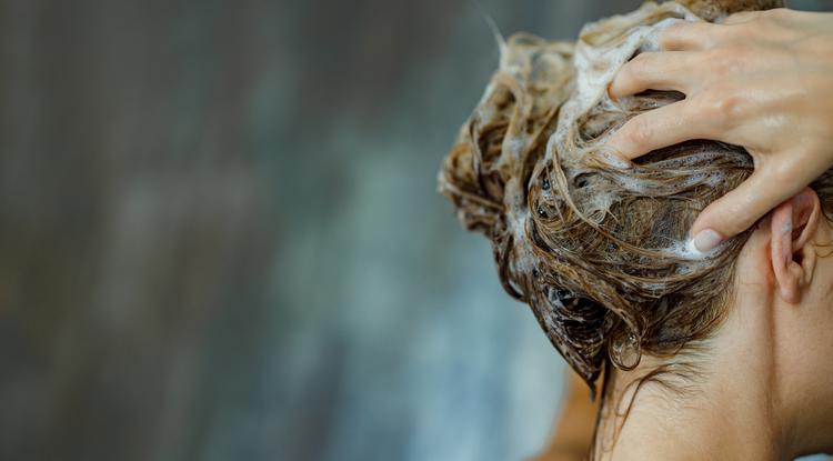Így kell helyesen hajat mosni Fotó: Getty Images