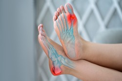 Dna moczanowa - objawy, przyczyny, rodzaje, leczenie, dieta