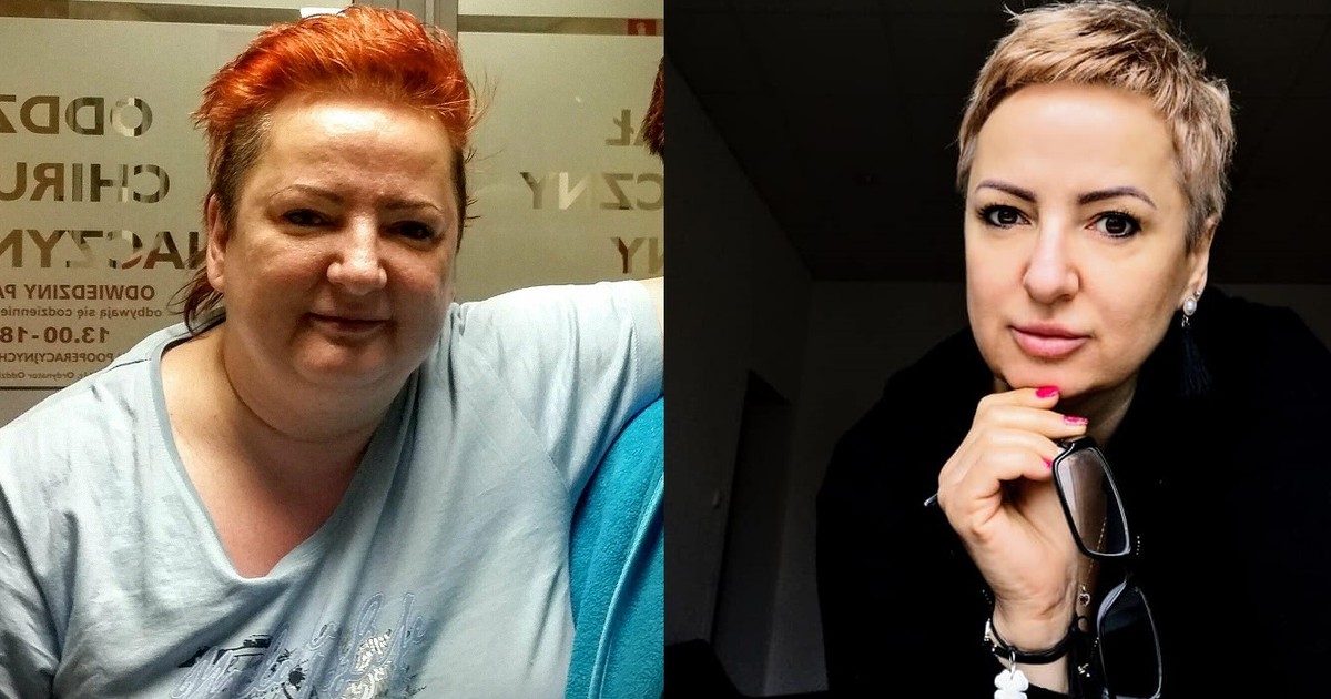 "Wreszcie sama mogłam zawiązać sznurówki". Nadwaga uniemożliwiała im codzienne funkcjonowanie
