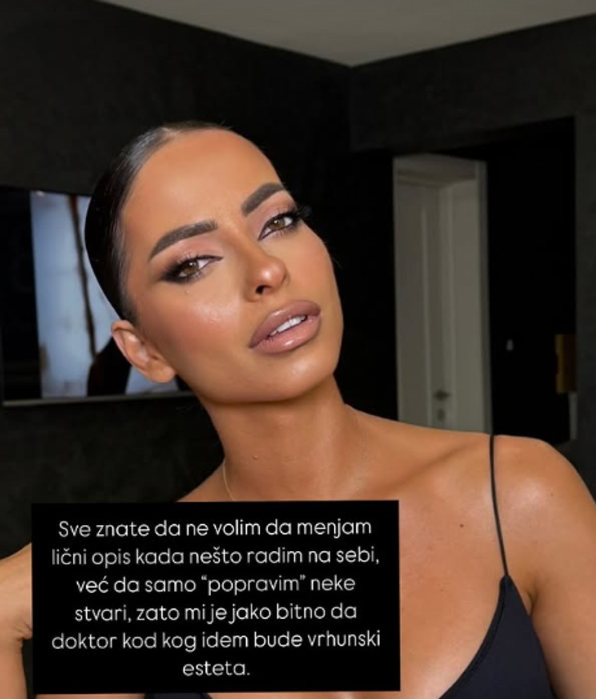 Kaća Lazić o estetskim zahvatima