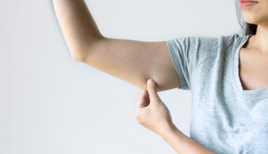 Visceralna masnoća