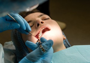 Operacija umnjaka je jedna od najčešćih hirurških intervencija kroz koje prolaze mladi odrasli ljudi